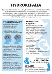 Hydrokefalia posteri, jossa kerrotaan mikä hydrokefalia on, miten se näkyy ihmisillä ja mistä se voi johtua. 